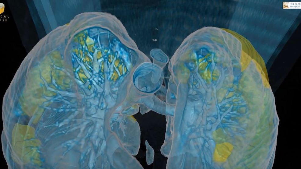 SON DAKİKA HABER: Corona virüsü hastalarının otopsisinde şok ayrıntı! Ölenlerde virüsün devamlılığı görüldü