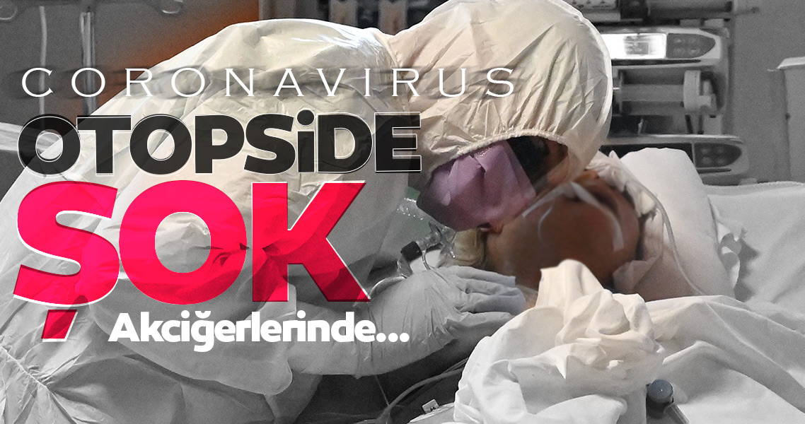 SON DAKİKA HABER: Corona virüsü hastalarının otopsisinde şok ayrıntı! Ölenlerde virüsün devamlılığı görüldü