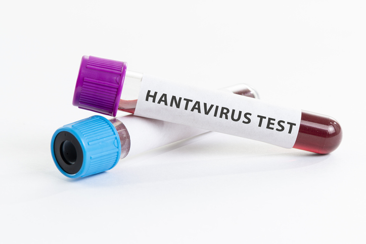 Hantavirüs nasıl bulaşır, belirtileri nelerdir? Covid-19 ile benzerlikleri var mı? İşte hanta virüs belirtilerinde yeni detaylar!