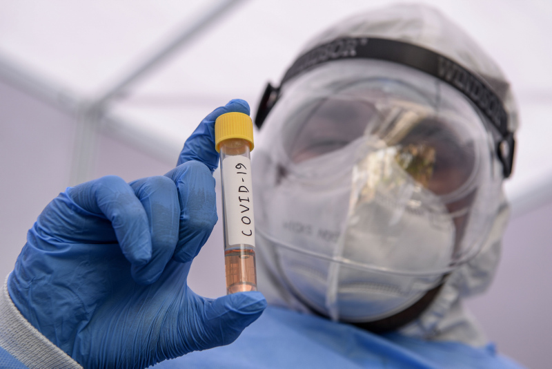 Son dakika... Bilim Kurulu üyesi Yamanel: Coronavirüse 8 metre yeter!