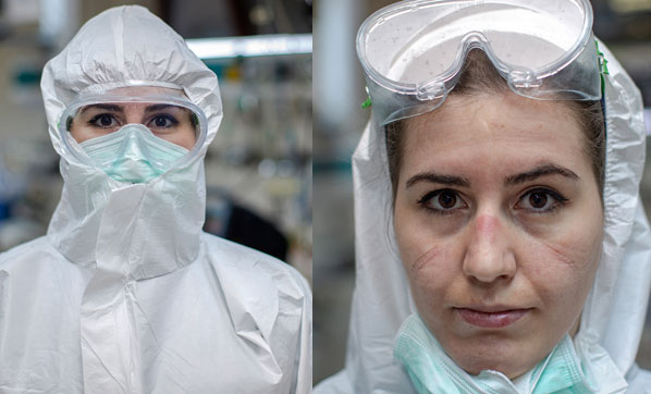 Acil servisin maskeli kahramanları!