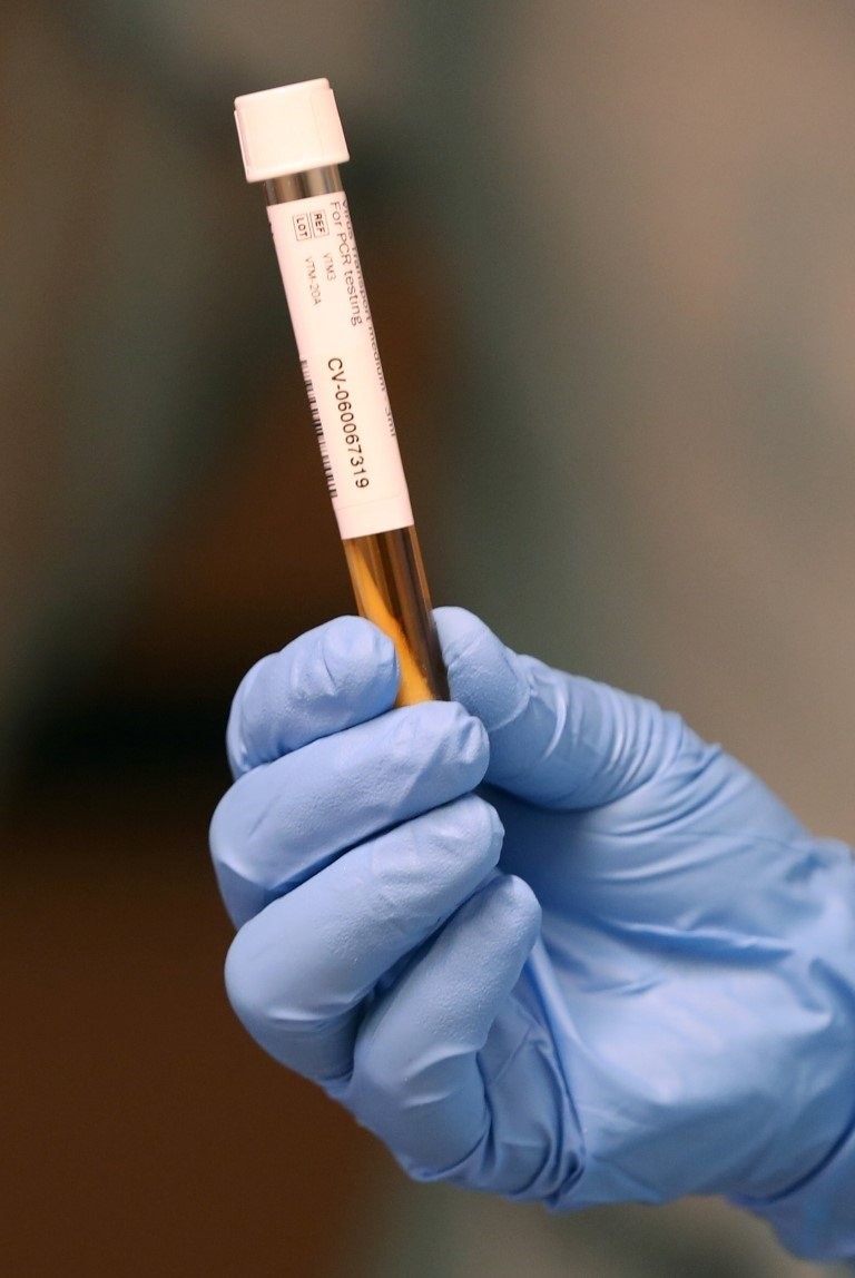 Son dakika haberi: ABD’de yapılan deneyler basına sızdı! Coronavirüsün ölmesi için...