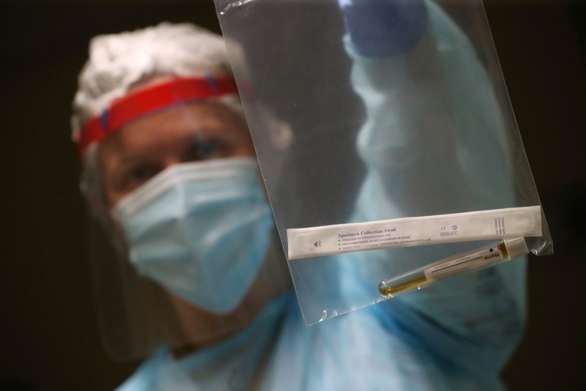 Son dakika haberi: ABD’de yapılan deneyler basına sızdı! Coronavirüsün ölmesi için...