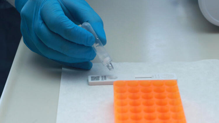 Deksametazon nedir? Deksametazon corona virüse karşı etkili mi? BBC’den flaş Son Dakika Haberi…