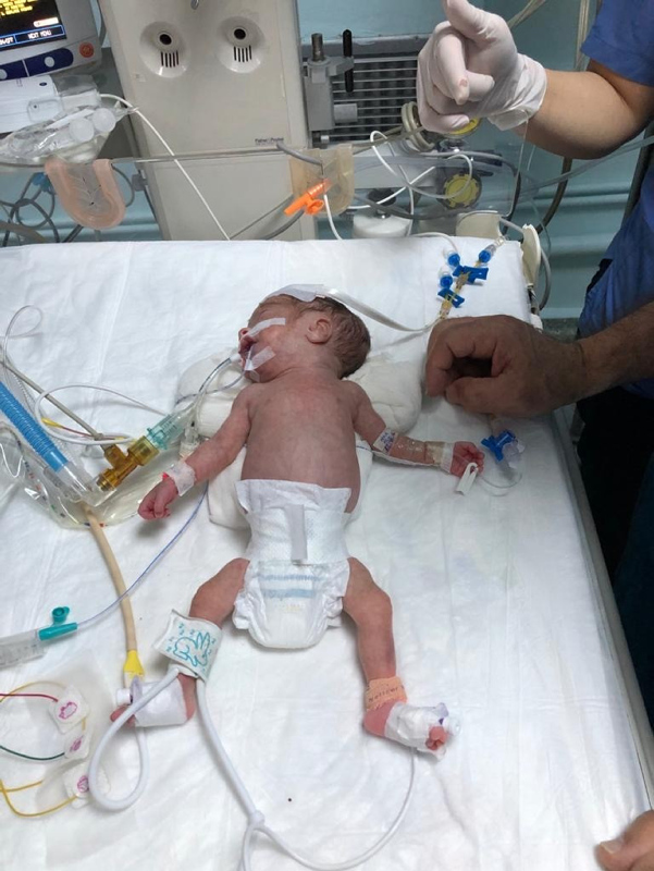 Son dakika: Prof.Dr. Cemil Taşçıoğlu Şehir Hastanesi’nde bir ilk! Küçük kalbe büyük operasyon...