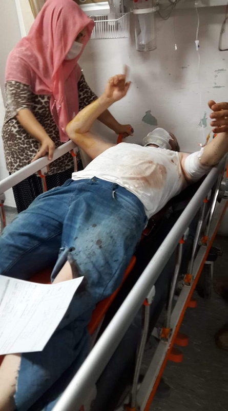 Son dakika: Sakarya’da havai fişek fabrikasında korkunç patlama! Çok sayıda ölü ve yaralı haberi geldi...