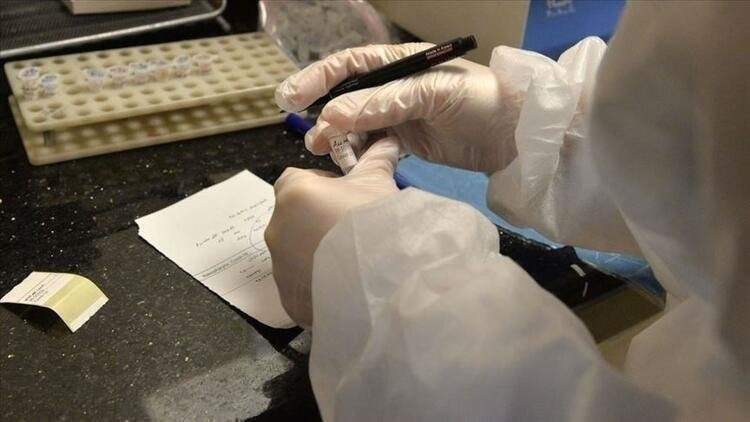 SON DAKİKA: Türkiye’deki güncel corona virüsü vaka ve ölüm sayısı açıklandı! 17 Temmuz Türkiye corona virüsü vaka, ölü ve iyileşen hasta sayısı kaç oldu?