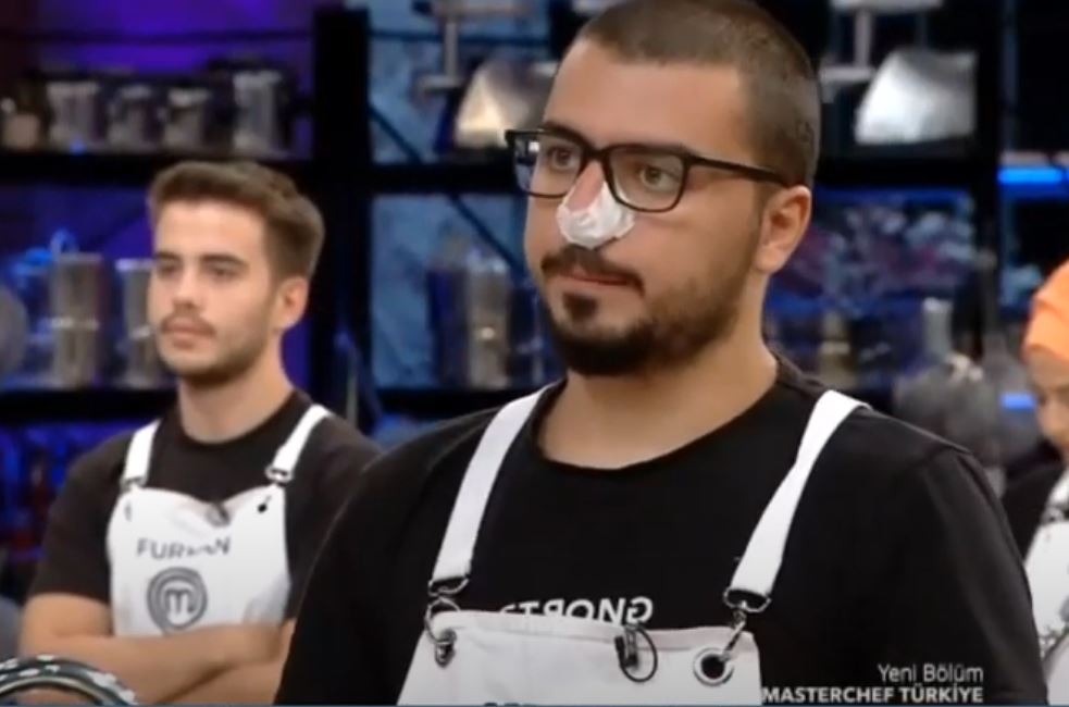 MasterChef Serhat’ın burnuna ne oldu? MasterChef Serhat Doğramacı canlı yayına burnu bandajlı olarak çıktı! İşte nedeni…