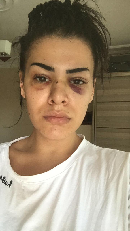 Son dakika haberi: Gasp, darp, cinsel saldırı... Genç kıza dehşeti yaşatmışlardı! İfadeleri ortaya çıktı...