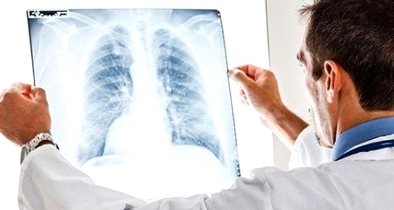 Son Dakika Corona virüs haberi! Sağlık Bakanı Fahrettin Koca en fazla pnömoni zatürre görülen illeri açıkladı!