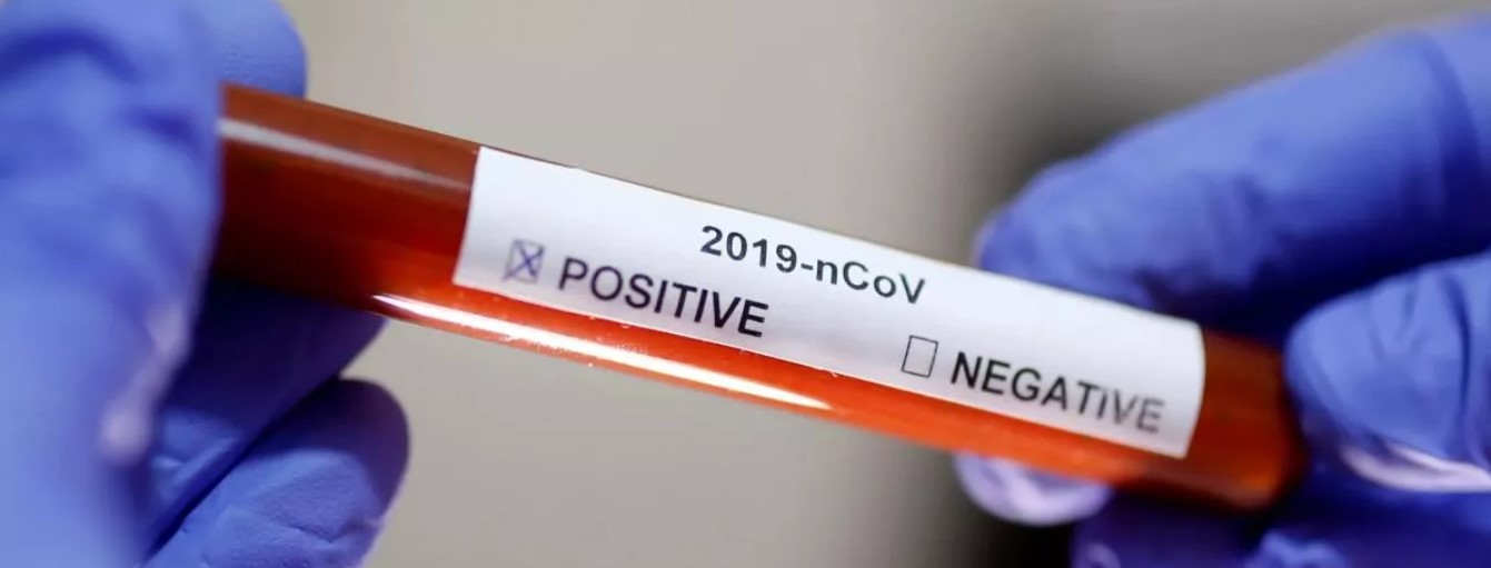 SON DAKİKA HABER | Koronavirüs geçirmiş olabilirsiniz… O belirtilere dikkat!