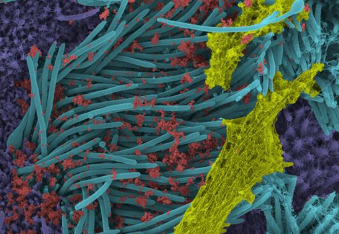 Son dakika haberi: Covid-19 ile ilgili çarpıcı görüntüler! Coronavirüs vücudu böyle işgal ediyor