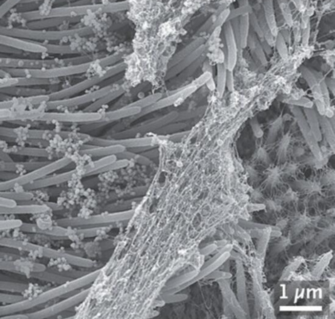 Son dakika haberi: Covid-19 ile ilgili çarpıcı görüntüler! Coronavirüs vücudu böyle işgal ediyor