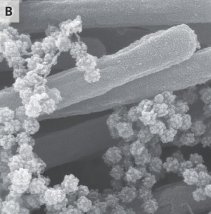Son dakika haberi: Covid-19 ile ilgili çarpıcı görüntüler! Coronavirüs vücudu böyle işgal ediyor