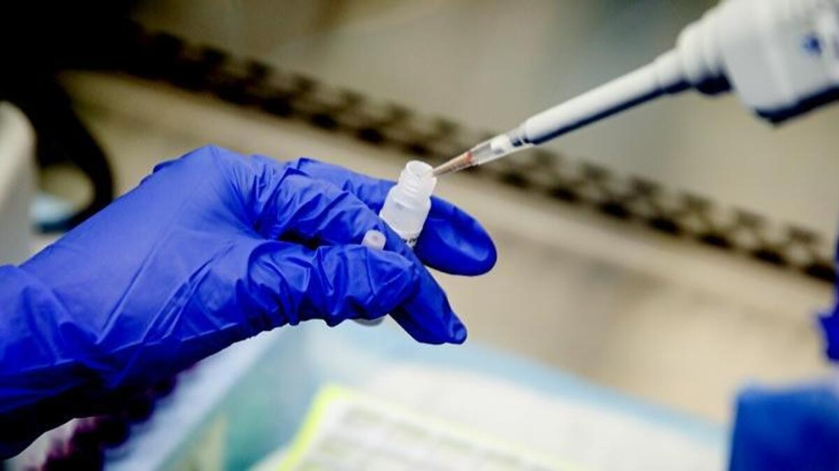 Koronavirüs için kritik açıklama! En geç Ocak 2021’de...