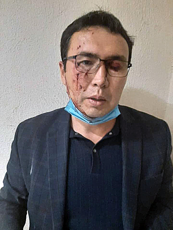 SON DAKİKA | Kırgızistan’da kaos gecesi: Seçimlerin ardından başlayan protestolarda son durum