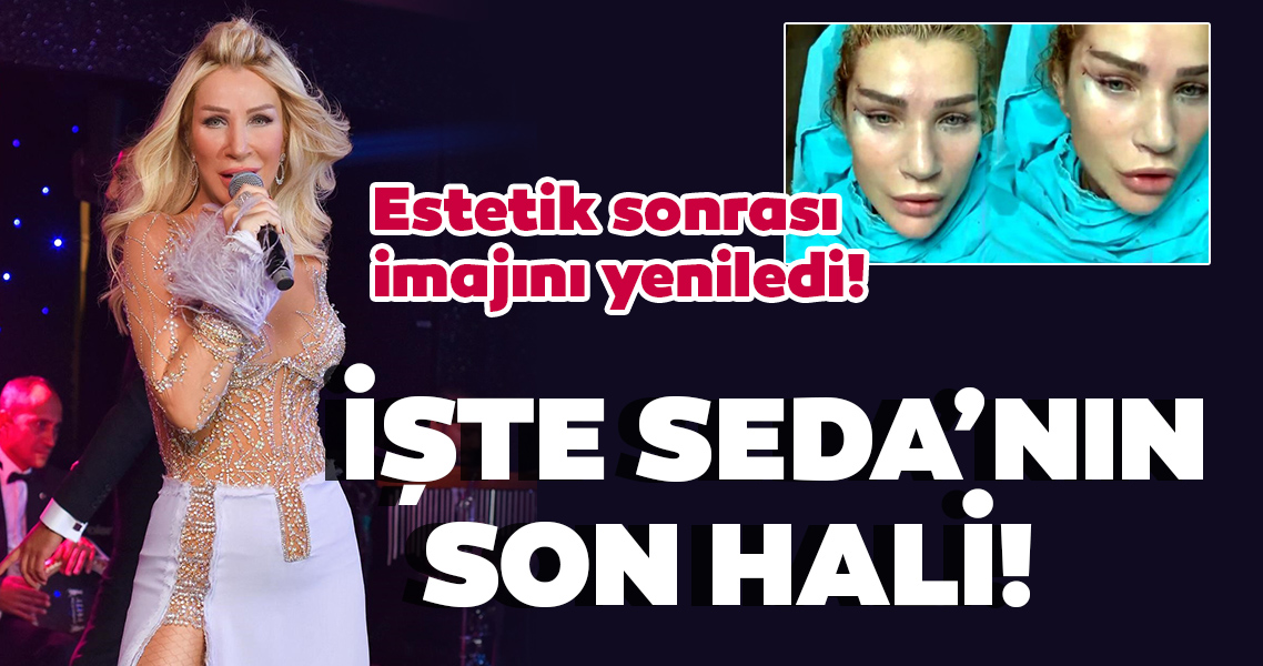 Seda Sayan Estetik Sonrasi Imajini Da Yeniledi Iste Fransiz Askisi Ile Yuzunu Gerdiren Seda Saya