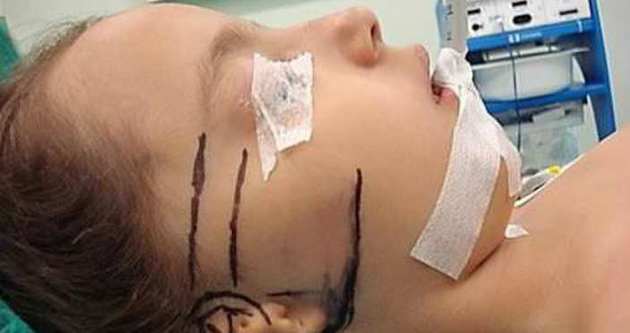 Türk doktor göğüs kafesinden kulak yaptı