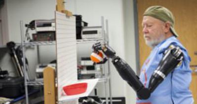 İki kollu olmayan hastaya robot protez takıldı!