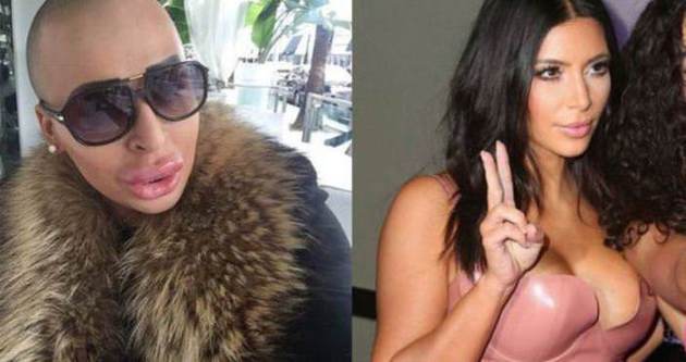 Kim Kardashian’a benzemek için servetini harcadı