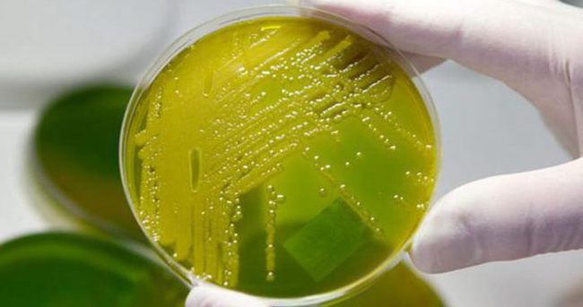Almanya’daki gizemli bakteri korkuttu