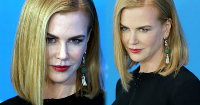 Nicole Kidman da botoxlular kervanına katıldı