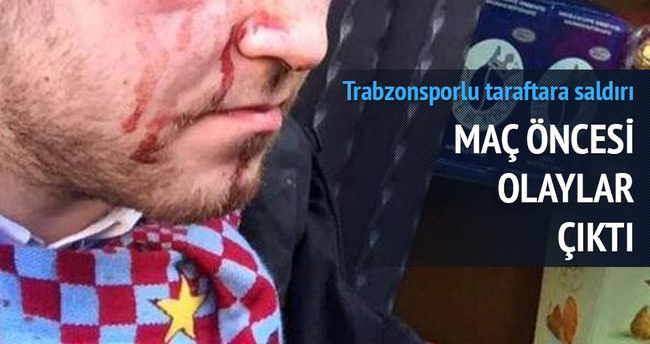 Napoli-Trabzonspor maçı öncesi kan aktı, 5 yaralı