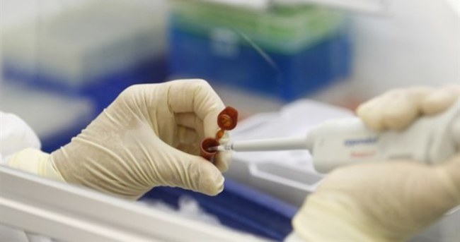 Sağlık Bakanlığı’ndan ’domuz gribi’ açıklaması