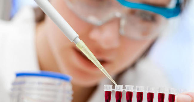 Kan testiyle kolayca saptanabiliyor