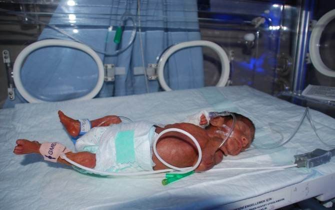 700 Gram Ağırlığındaki Bebek Hayata Tutunamadı