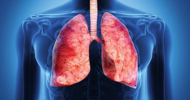 İleri evre akciğer kanserinde yaşam süresi arttı