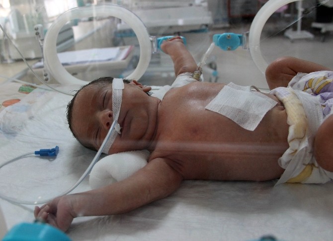 Özel Haber Anne Karnında Teşhis Bebeğin Hayatını Kurtardı