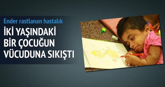 İki yaşındaki bir çocuğun vücuduna sıkıştı