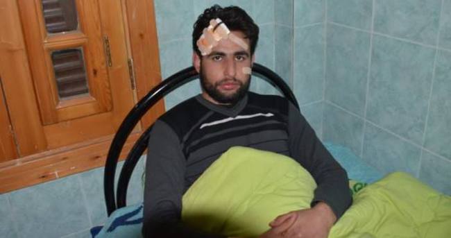 AA kameramanı Suriye’de roket saldırısında yaralandı