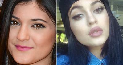 Kylie Jenner dudaklarının sırrını açıkladı