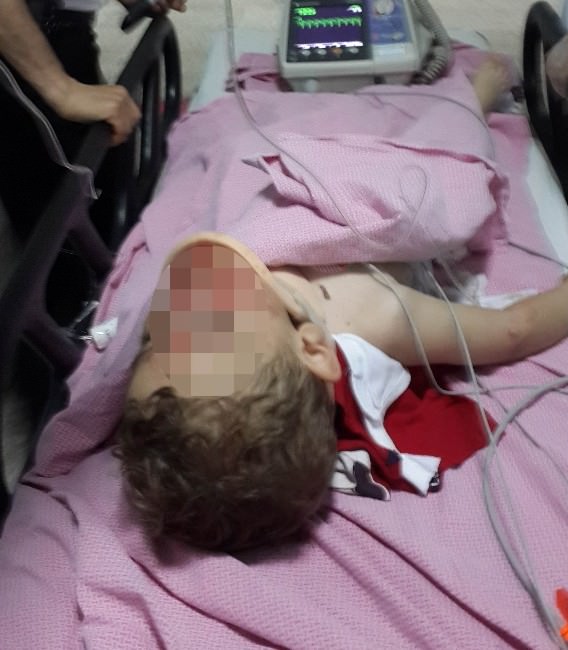 Samsun’da 4. Katın Penceresinden Düşen Çocuk Ağır Yaralandı