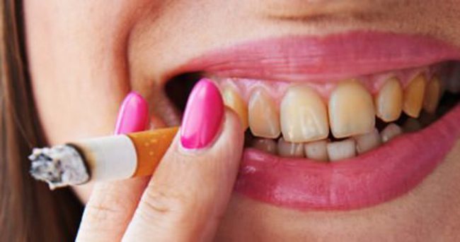Sigara içenler dişlerini daha çabuk kaybediyor