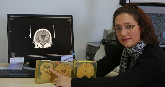 Beynin sırlarını çözmek için organ bağışı bekleniyor