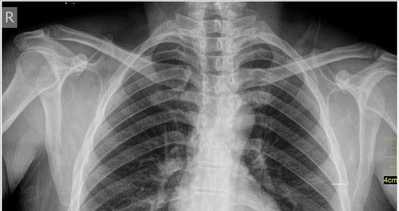 Sağlıkta ’dijital röntgen’ dönemi