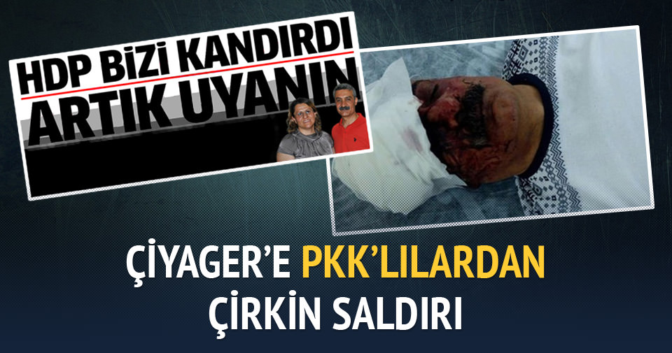 Çiyager’e PKK’lılardan çirkin saldırı