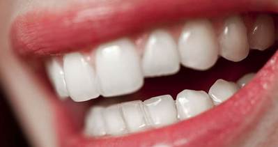 Dişlerin sararması nasıl önlenir?