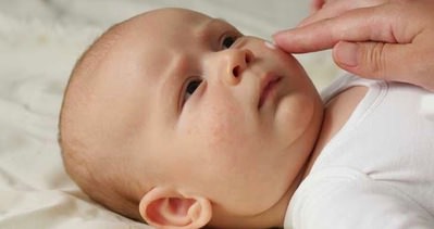 Alerjik egzama çocuklarda uykusuzluğa yol açıyor