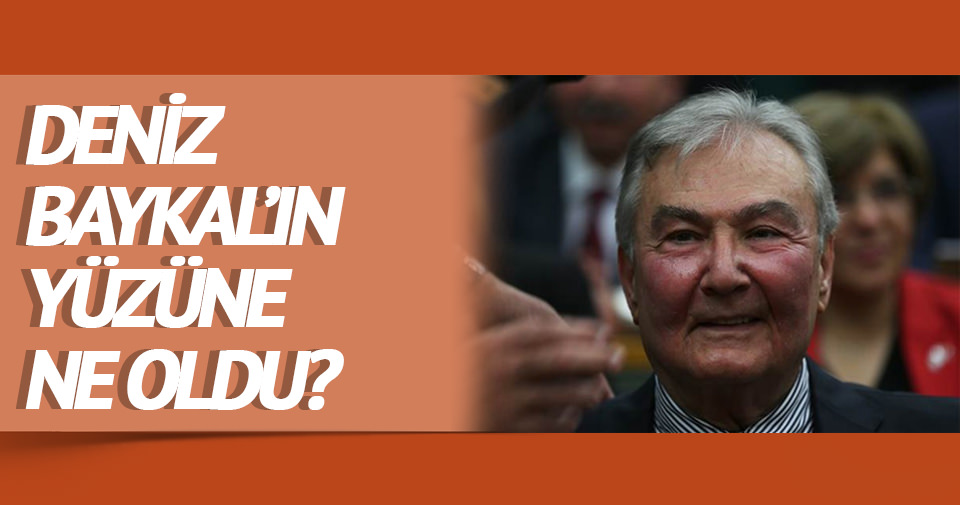 Deniz Baykal�ın yüzüne ne oldu? Son Dakika Haberler