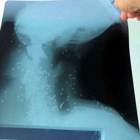 Yaralı köpeğin röntgen filmini görenler şoke oldu