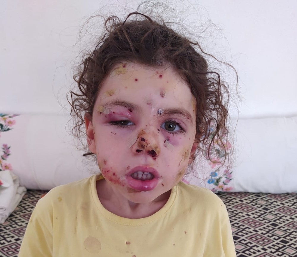 İzmir’de yasak dinlemeyen magandalar 5 yaşındaki Neriman’ı silahla yaraladı