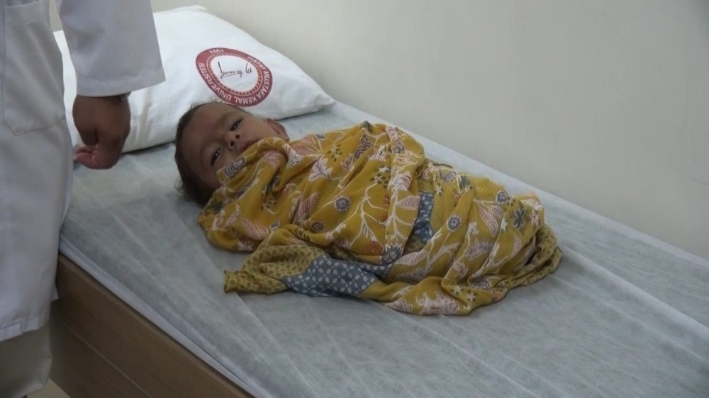 Uzuvları olmayan İdlibli bebek Türkiye’de tedavi altına alındı