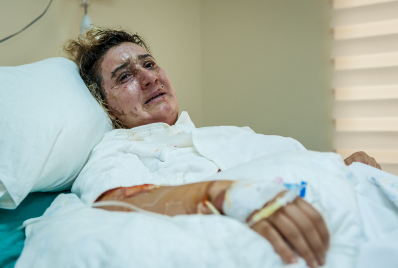 Yüzüne kızgın yağ dökülüp yakılmıştı: Tek isteğim yeni bir hayat kurmak!