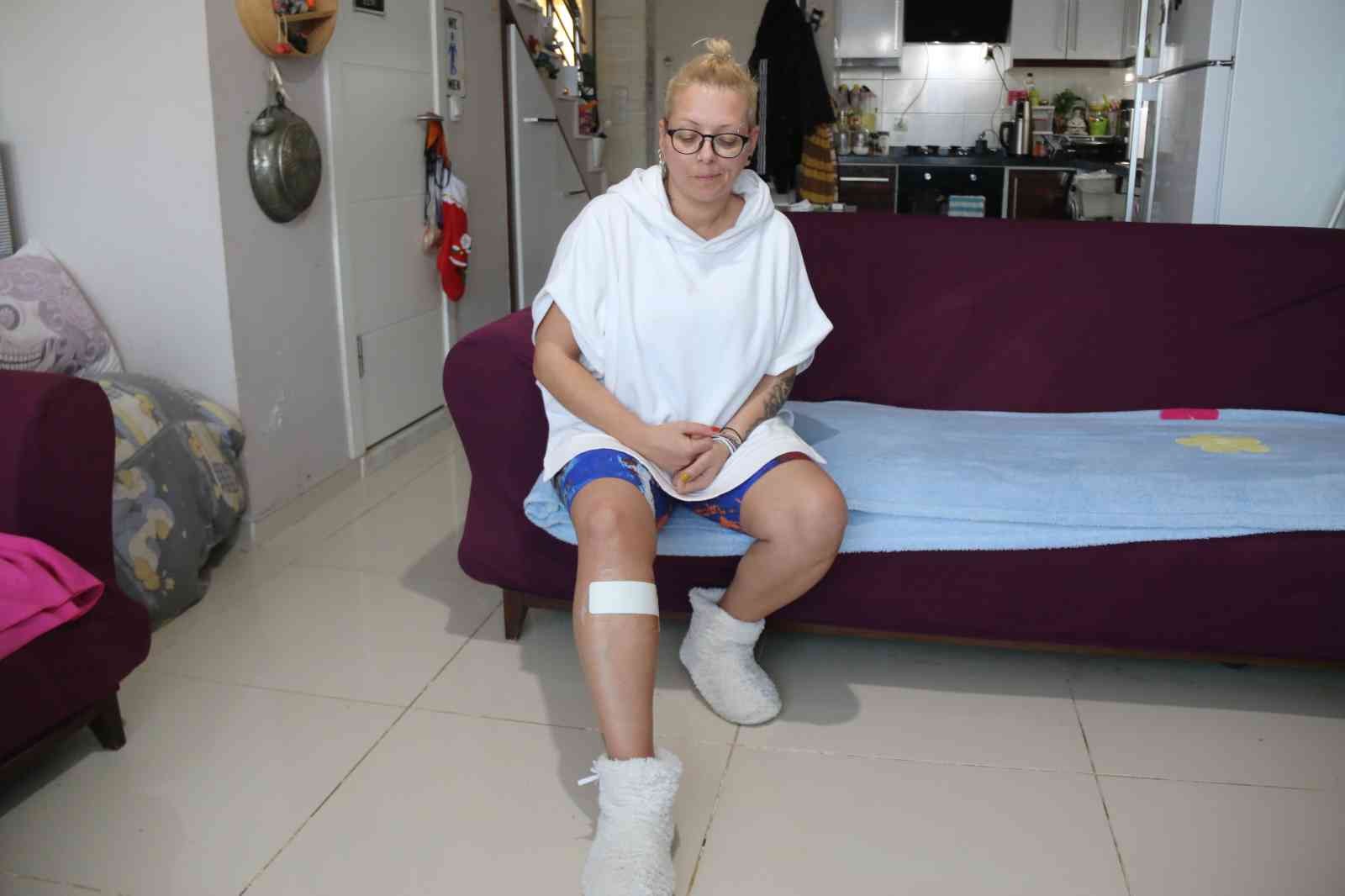 Antalya’da sokak köpeği tarafından ısırılan aşçı kadın kabusu yaşadı #antalya