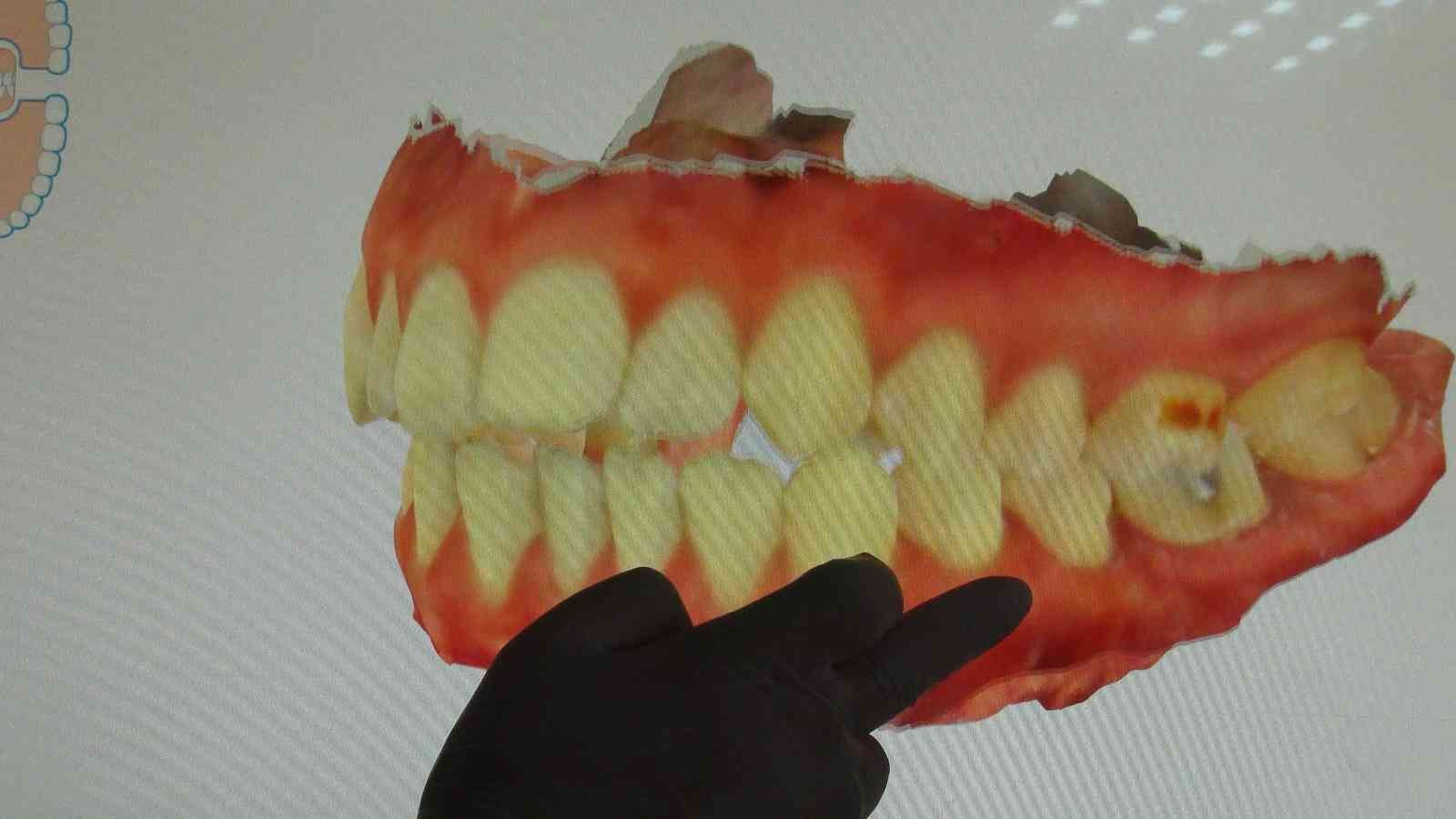 Korona virüs diş ağrılarını arttırdı #van