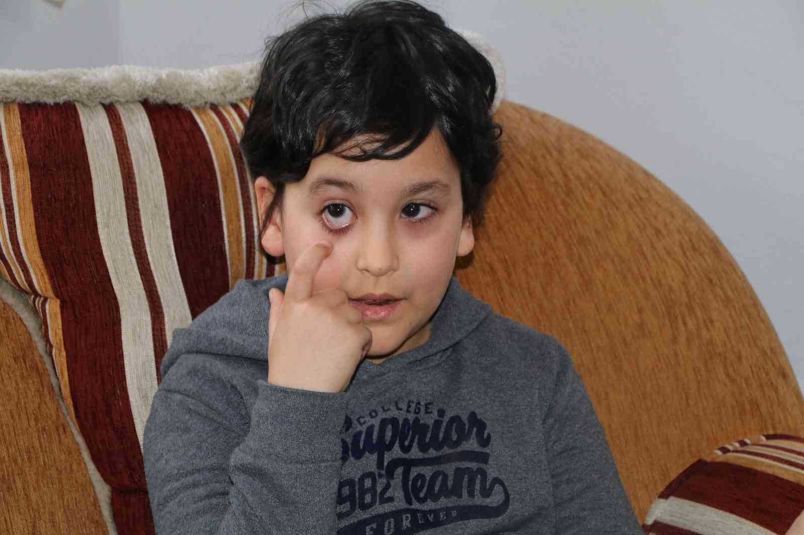 Daha 8 yaşında 9. kez göz ameliyatı olacak #rize
